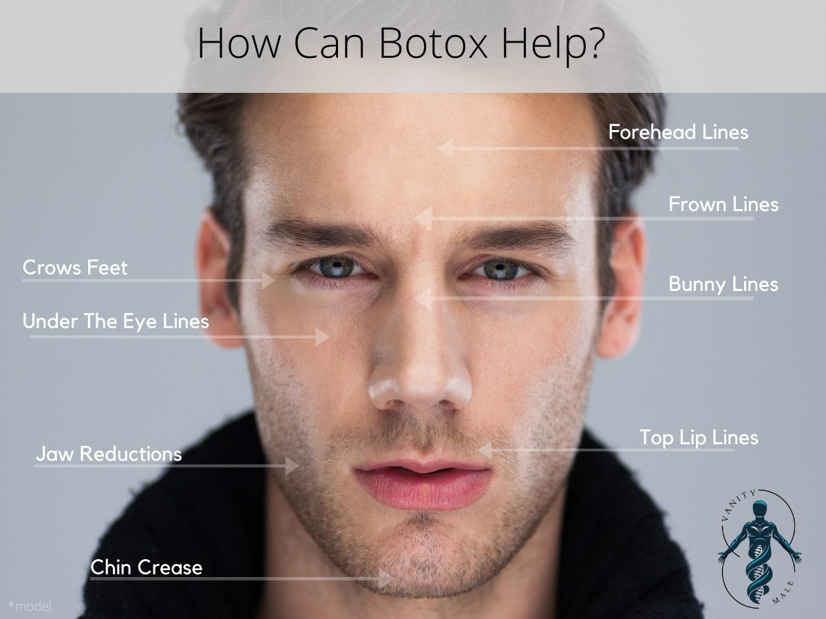 How can Botox help?