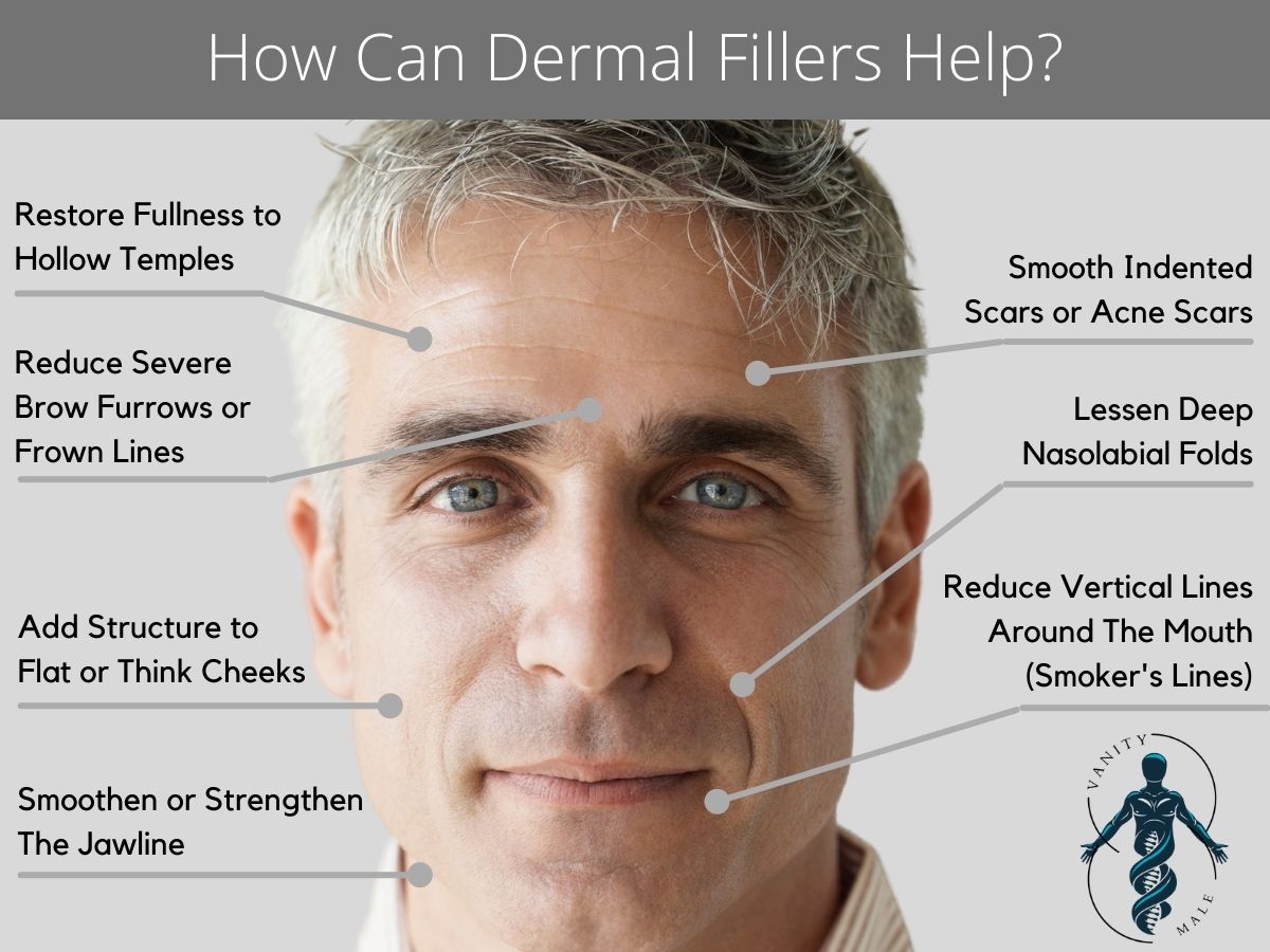 How can Dermal Fillers help?