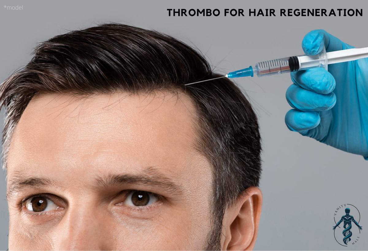 Thrombo Hair Regeneration for Men