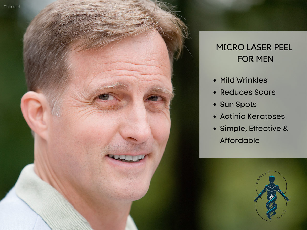 Micro Laser Peel for Men