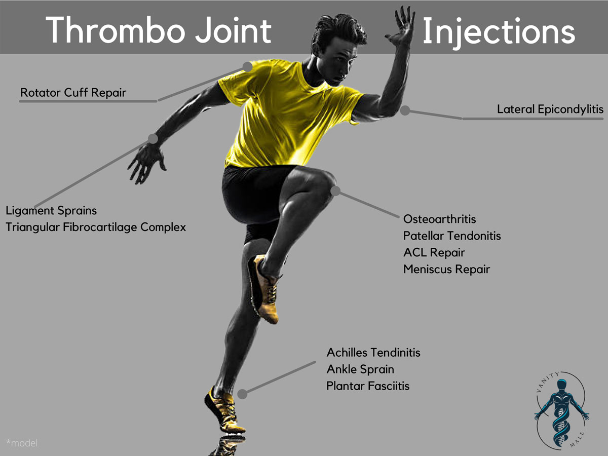 Thrombo PRP Joint Injections for Men