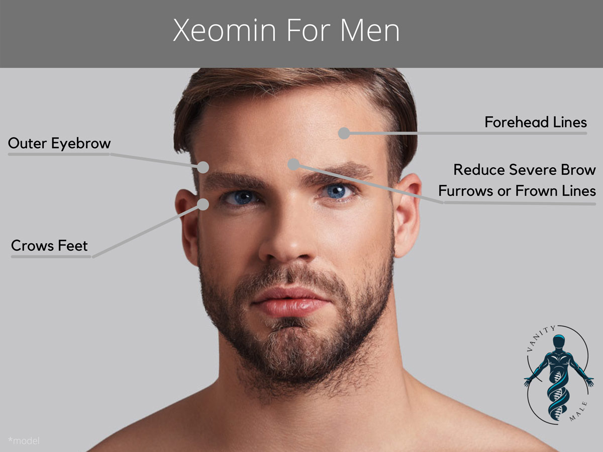 botox men forehead