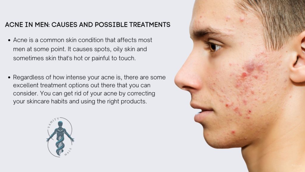 Acne in Men; Causes and Possible Treatments