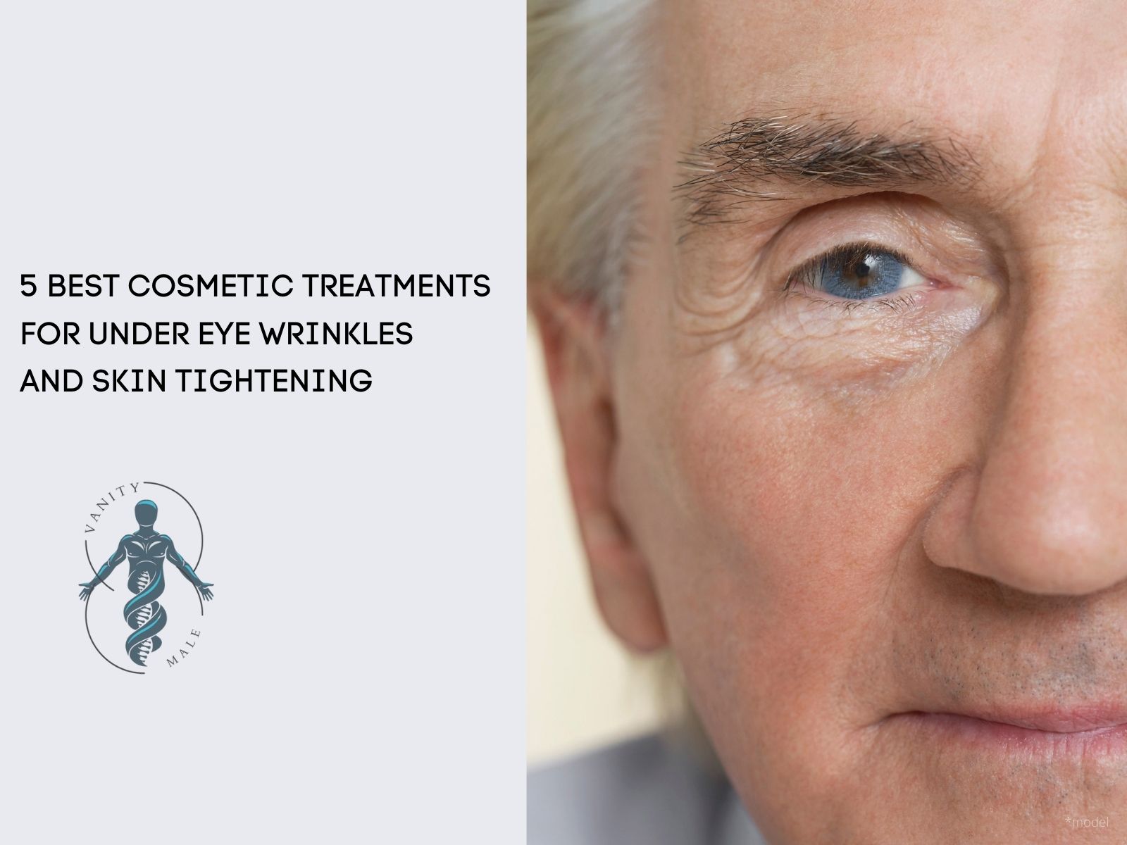 5 Best Cosmetic Treatments for Under Eye Wrinkles and Skin Tightening
